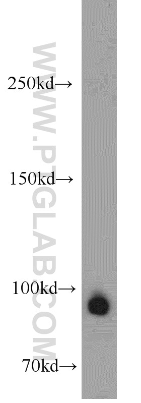 Western Blot (WB) analysis of HeLa cells using Drosha Polyclonal antibody (55001-1-AP)