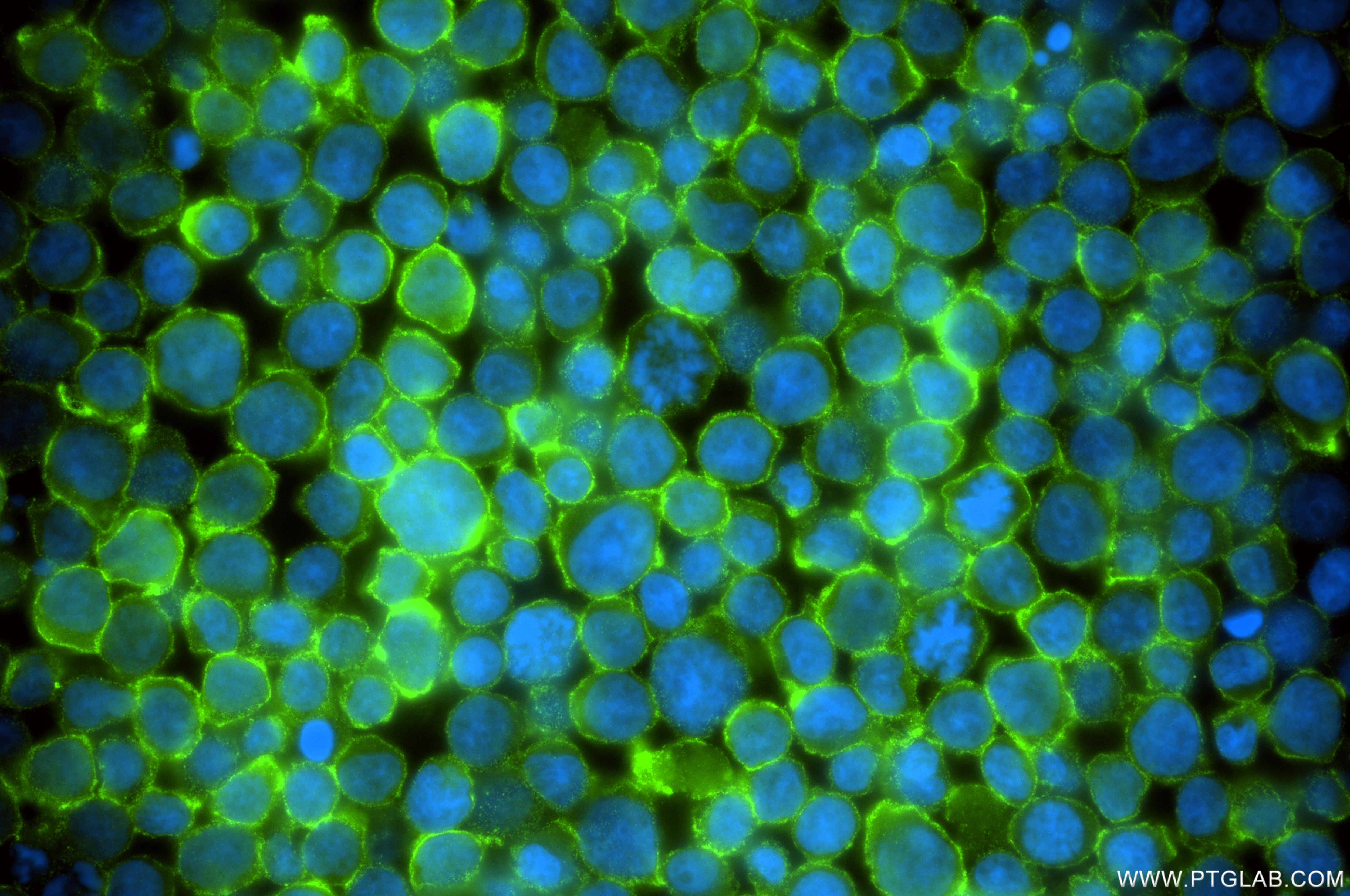 IF Staining of Jurkat using 85025-6-RR Immunofluorescence (IF) / fluorescent staining of Jurkat cells using Dysadherin Recombinant monoclonal antibody (85025-6-RR)