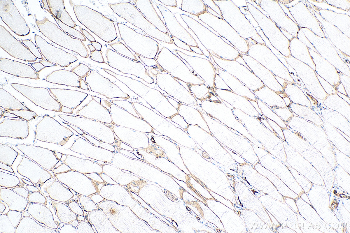 Immunohistochemistry (IHC) staining of rat skeletal muscle tissue using Dystrophin Monoclonal antibody (68120-1-Ig)