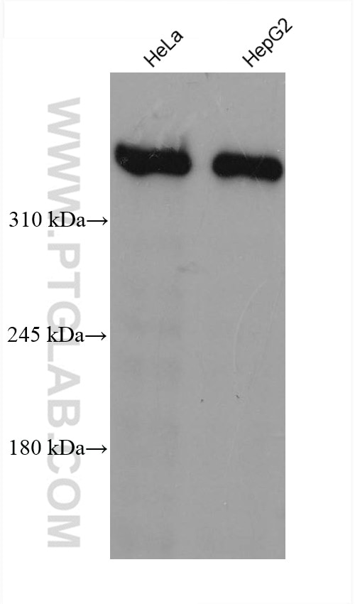 Western Blot (WB) analysis of various lysates using Dystrophin Monoclonal antibody (68120-1-Ig)