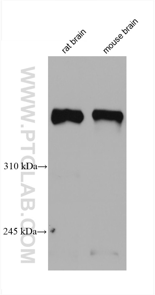 Western Blot (WB) analysis of various lysates using Dystrophin Monoclonal antibody (68120-1-Ig)