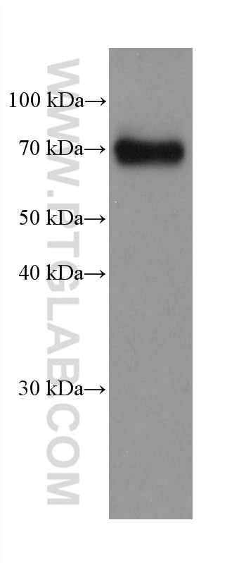 Western Blot (WB) analysis of HeLa cells using Dystrophin Monoclonal antibody (68120-1-Ig)