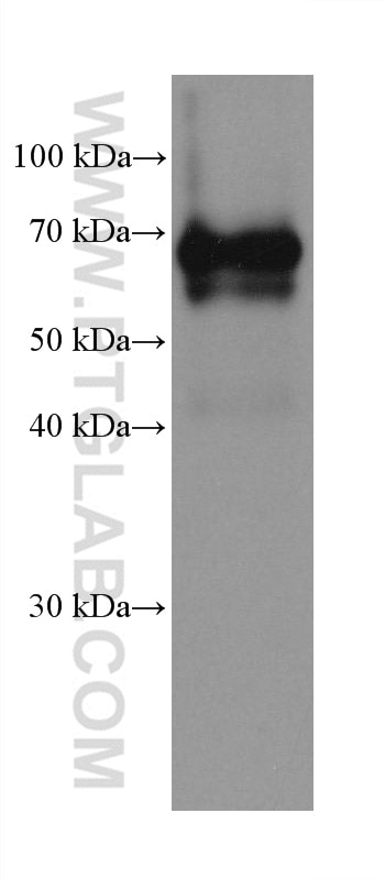 Western Blot (WB) analysis of rat heart tissue using Dystrophin Monoclonal antibody (68120-1-Ig)