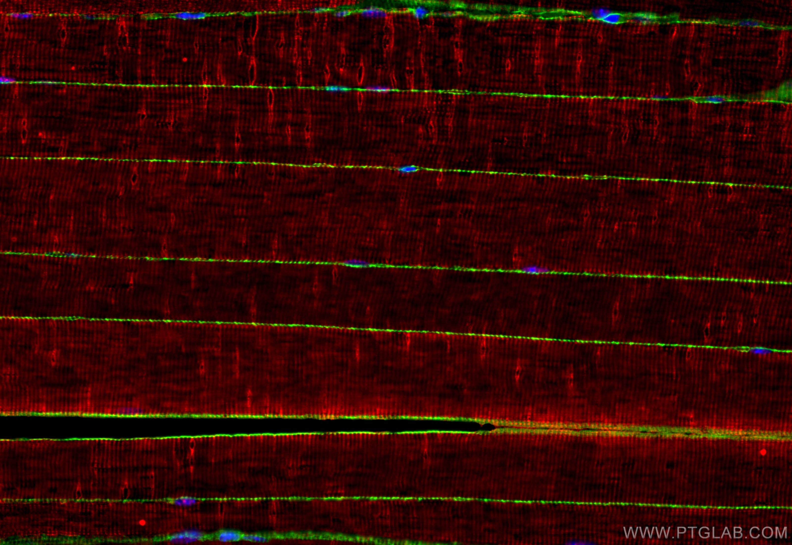 Dystrophin