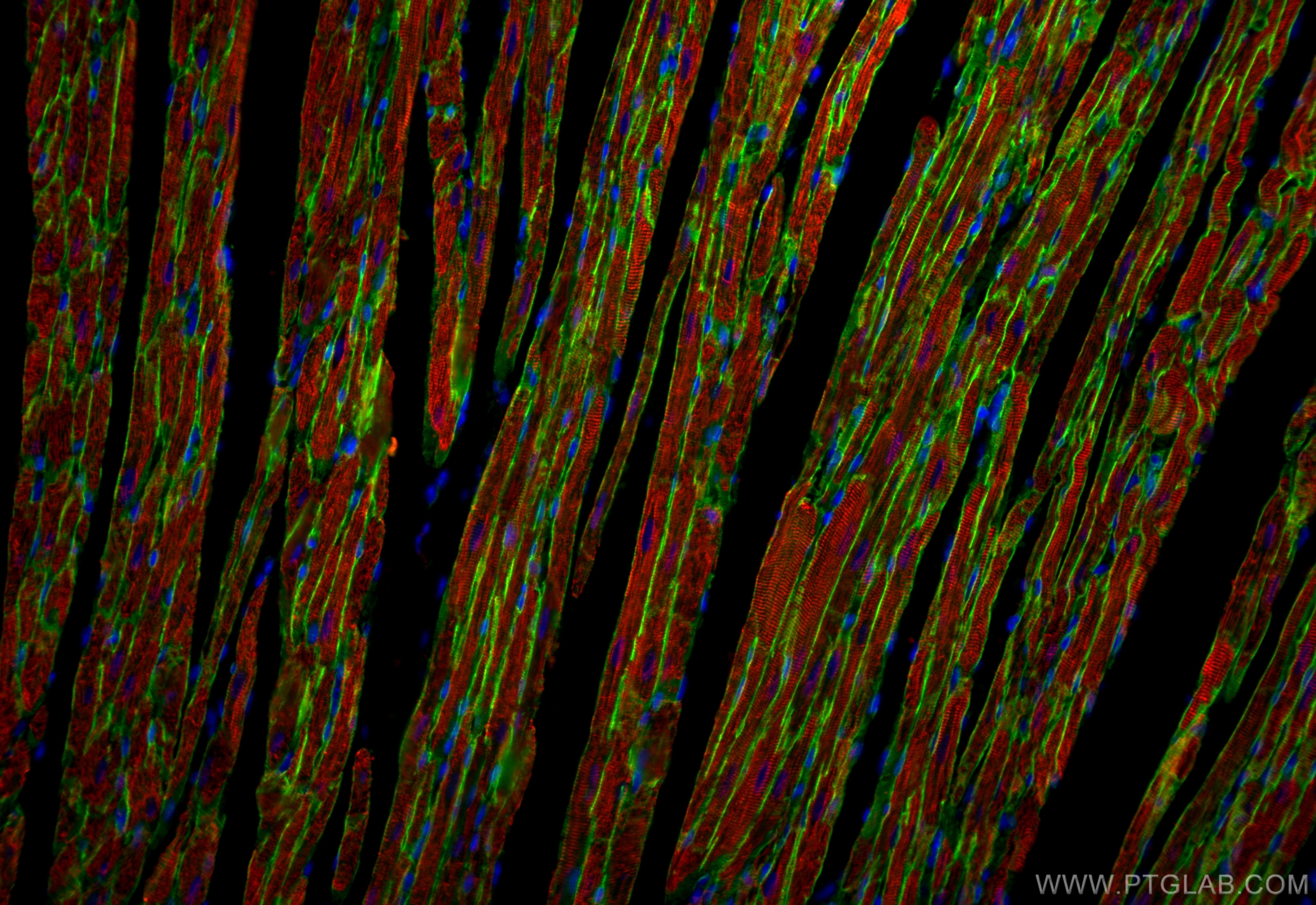 Immunofluorescence (IF) / fluorescent staining of rat heart tissue using Dystrophin Recombinant antibody (83609-5-RR)