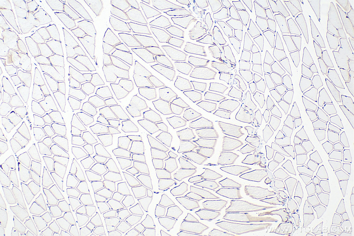 Immunohistochemistry (IHC) staining of mouse skeletal muscle tissue using Dystrophin Recombinant monoclonal antibody (83609-5-RR)