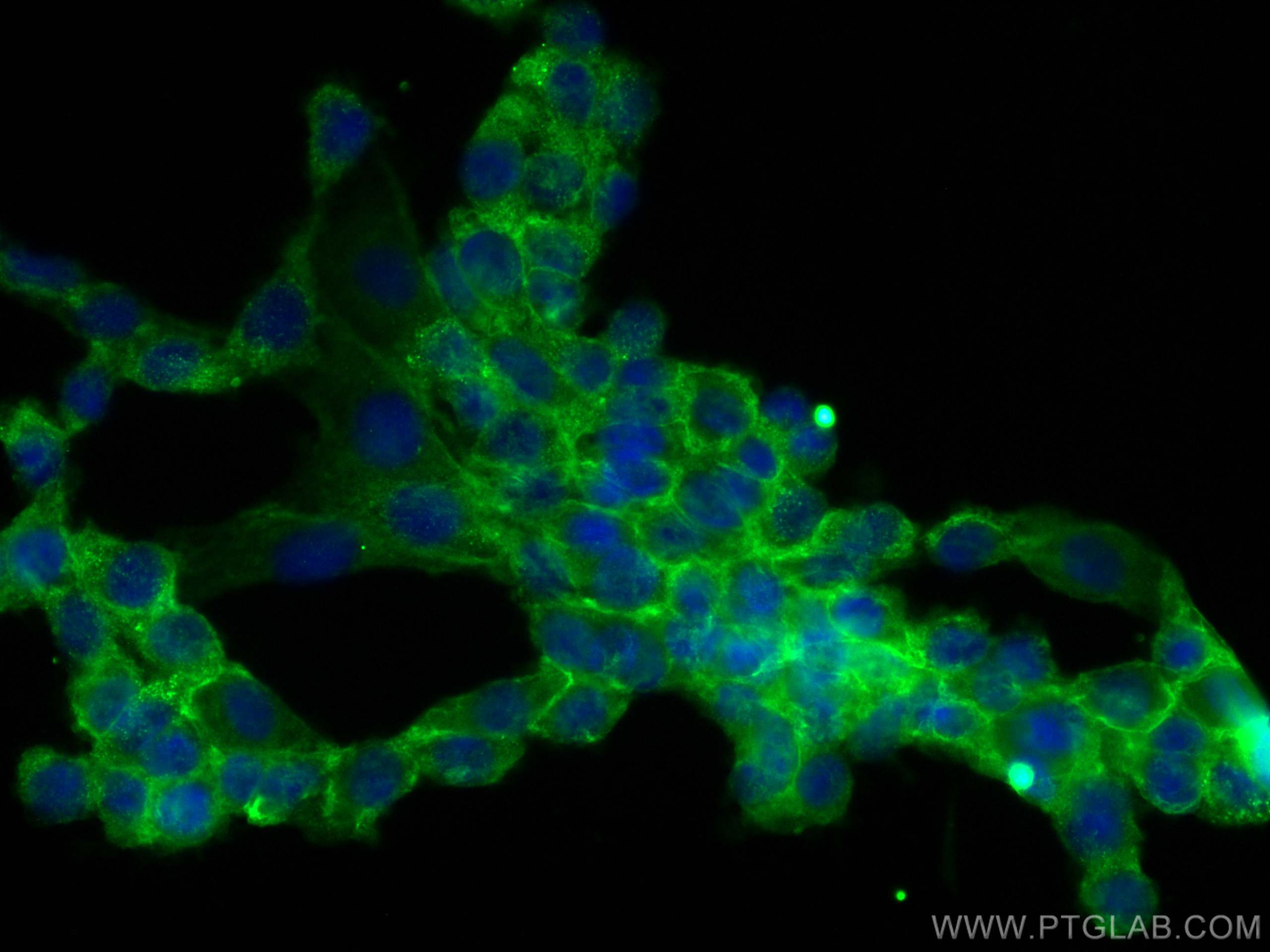 Immunofluorescence (IF) / fluorescent staining of H9C2 cells using CoraLite® Plus 488-conjugated Dystrophin Monoclona (CL488-68120)