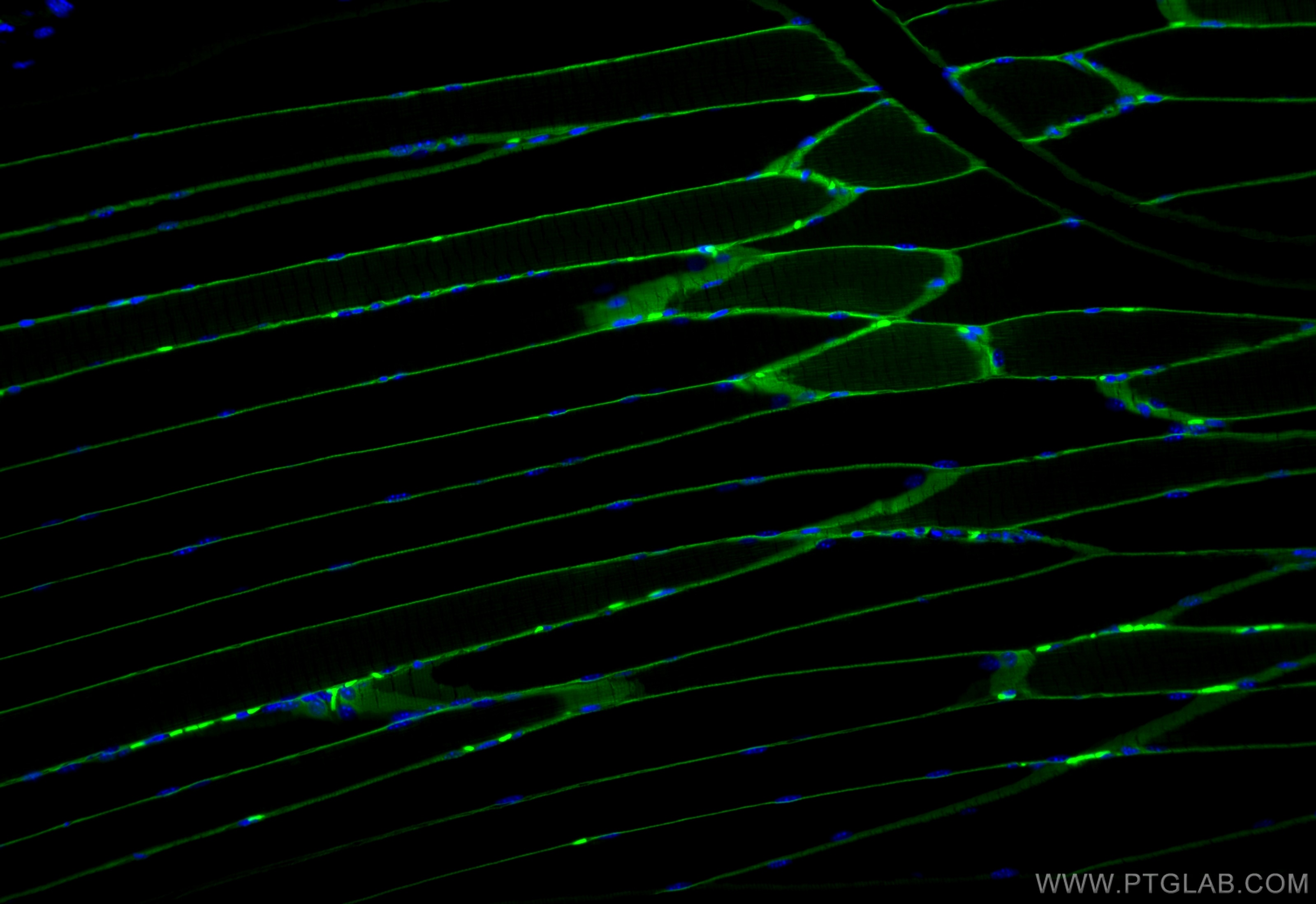 Immunofluorescence (IF) / fluorescent staining of mouse skeletal muscle tissue using CoraLite® Plus 488-conjugated Dystrophin Recombina (CL488-83609-5)