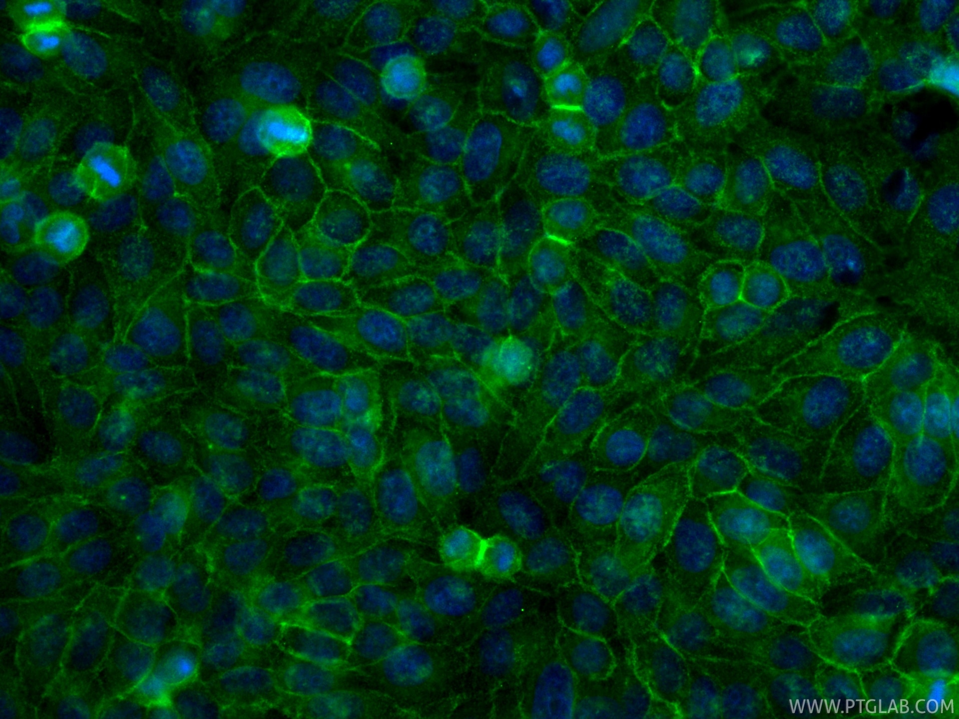 Immunofluorescence (IF) / fluorescent staining of HepG2 cells using CoraLite® Plus 488-conjugated Dystrophin Recombina (CL488-83609-6)