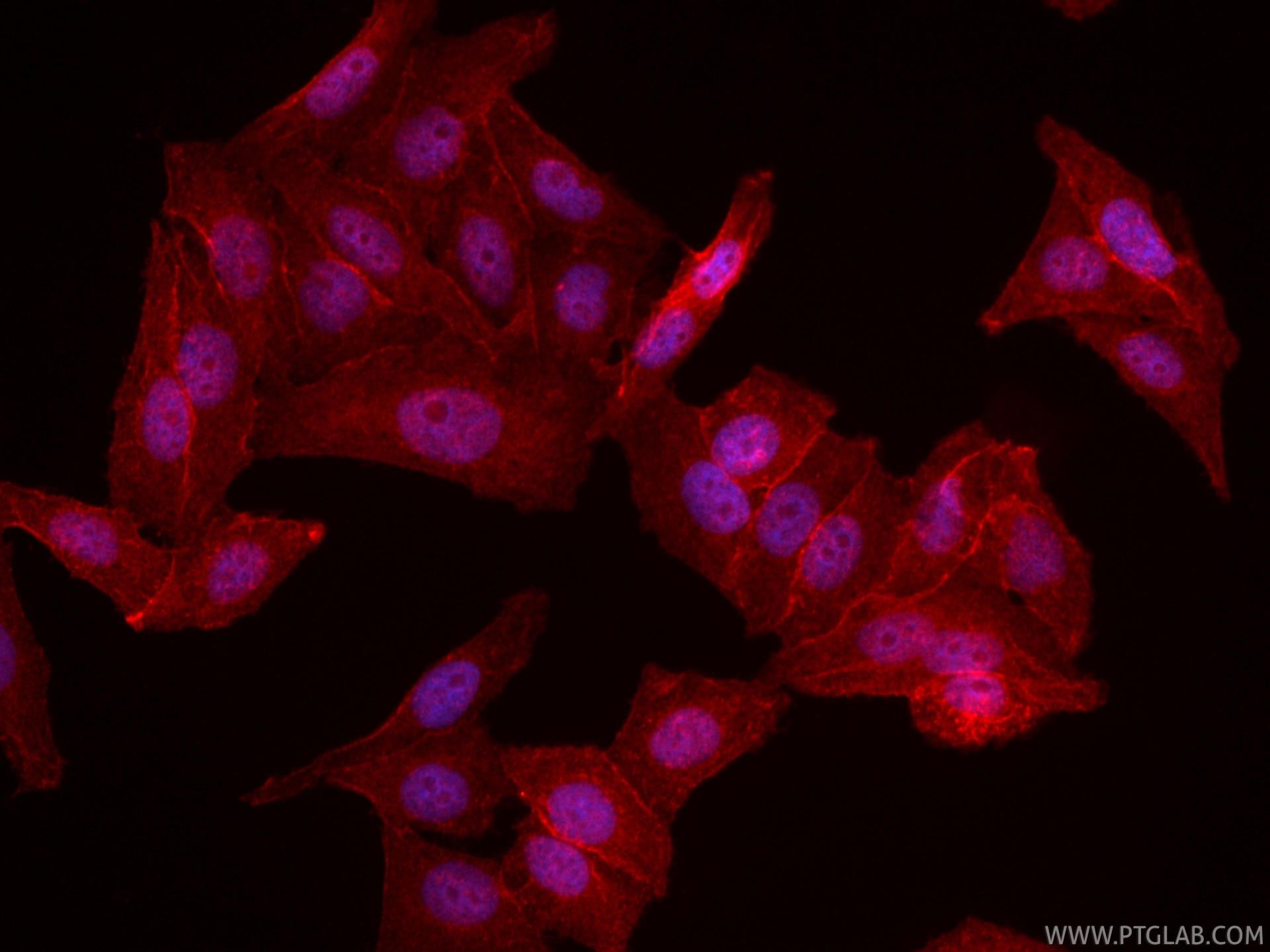 Immunofluorescence (IF) / fluorescent staining of HepG2 cells using CoraLite®594-conjugated Dystrophin Recombinant mon (CL594-83609-6)
