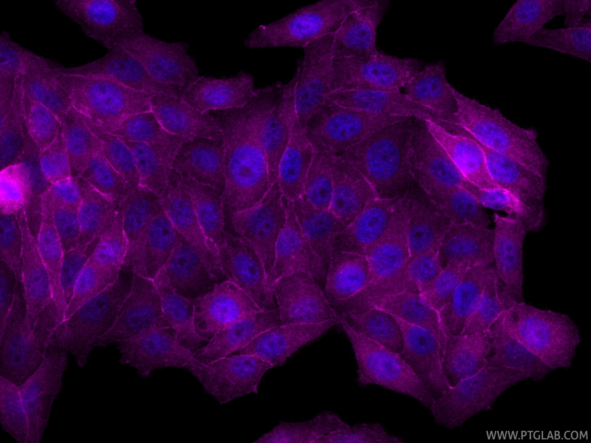 Immunofluorescence (IF) / fluorescent staining of HepG2 cells using CoraLite® Plus 647-conjugated Dystrophin Recombina (CL647-83609-6)