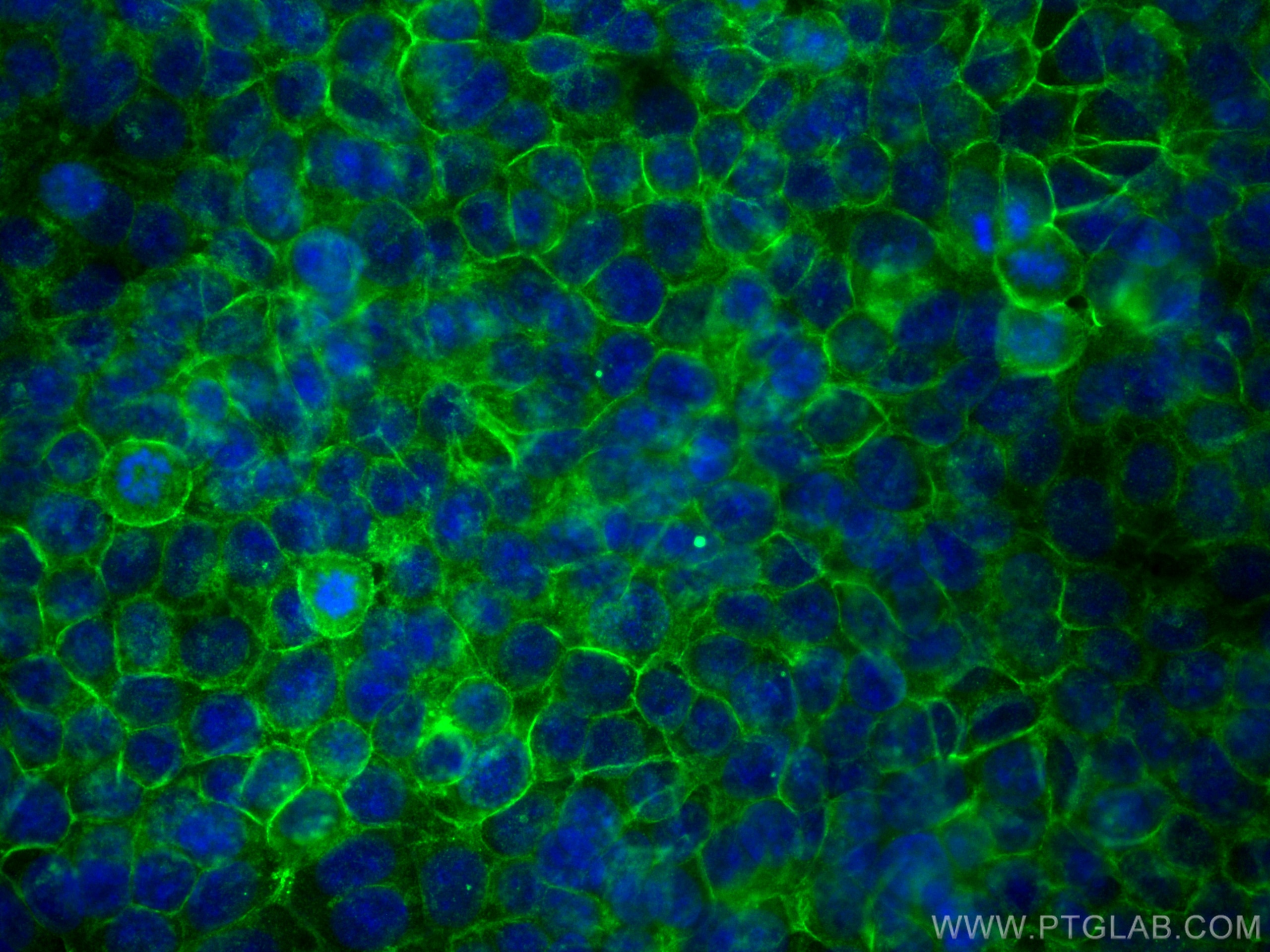 Immunofluorescence (IF) / fluorescent staining of MCF-7 cells using E-Cadherin Polyclonal antibody (31863-1-AP)
