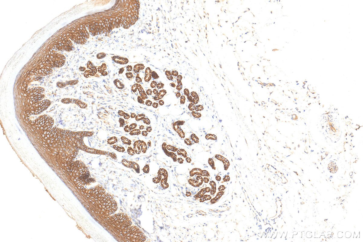 Immunohistochemistry (IHC) staining of mouse skin tissue using E-Cadherin Polyclonal antibody (31863-1-AP)