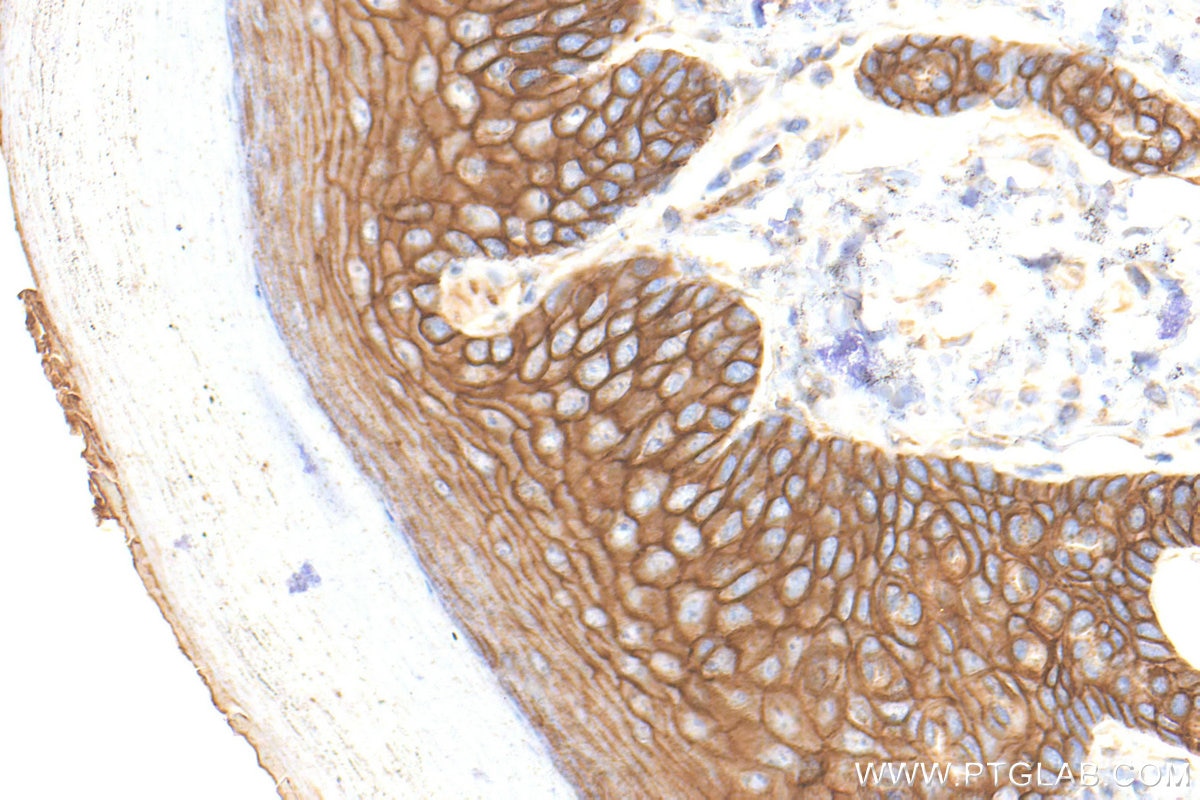 Immunohistochemistry (IHC) staining of mouse skin tissue using E-Cadherin Polyclonal antibody (31863-1-AP)