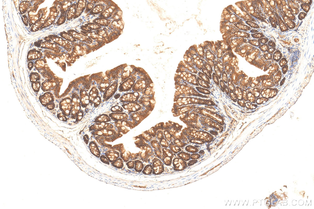 Immunohistochemistry (IHC) staining of mouse colon tissue using E-Cadherin Polyclonal antibody (31863-1-AP)