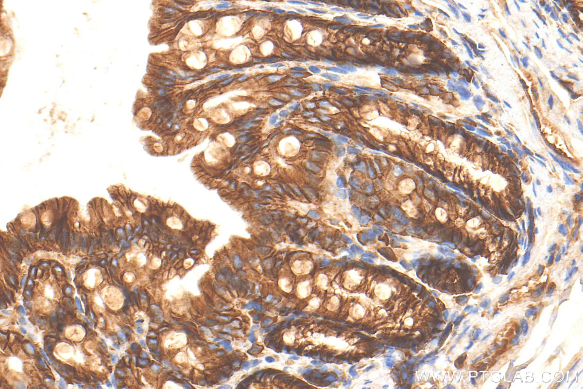 Immunohistochemistry (IHC) staining of mouse colon tissue using E-Cadherin Polyclonal antibody (31863-1-AP)