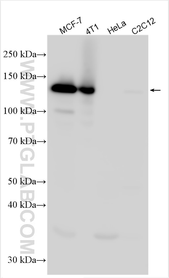 Western Blot (WB) analysis of various lysates using E-Cadherin Polyclonal antibody (31863-1-AP)