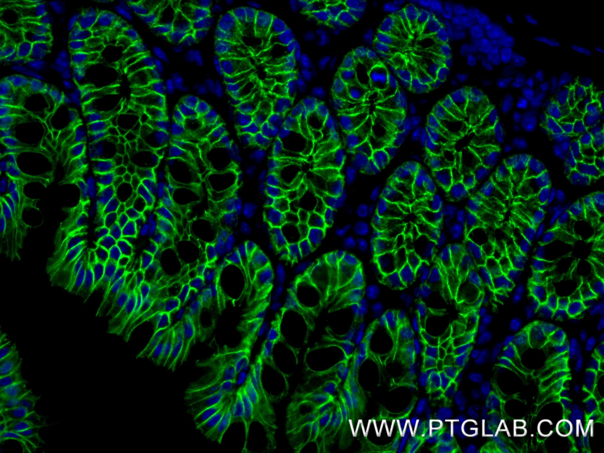 IF Staining of mouse colon using 84111-1-RR Immunofluorescence (IF) / fluorescent staining of mouse colon tissue using E-cadherin Recombinant monoclonal antibody (84111-1-RR)