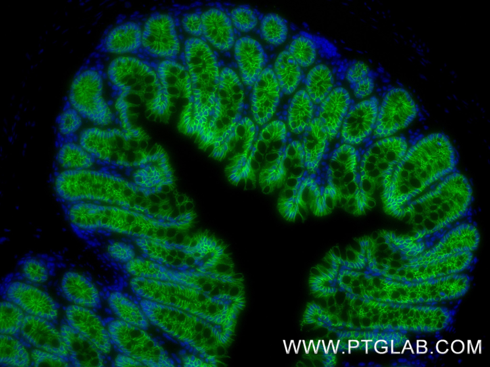 IF Staining of mouse colon using 84111-1-RR Immunofluorescence (IF) / fluorescent staining of mouse colon tissue using E-cadherin Recombinant monoclonal antibody (84111-1-RR)