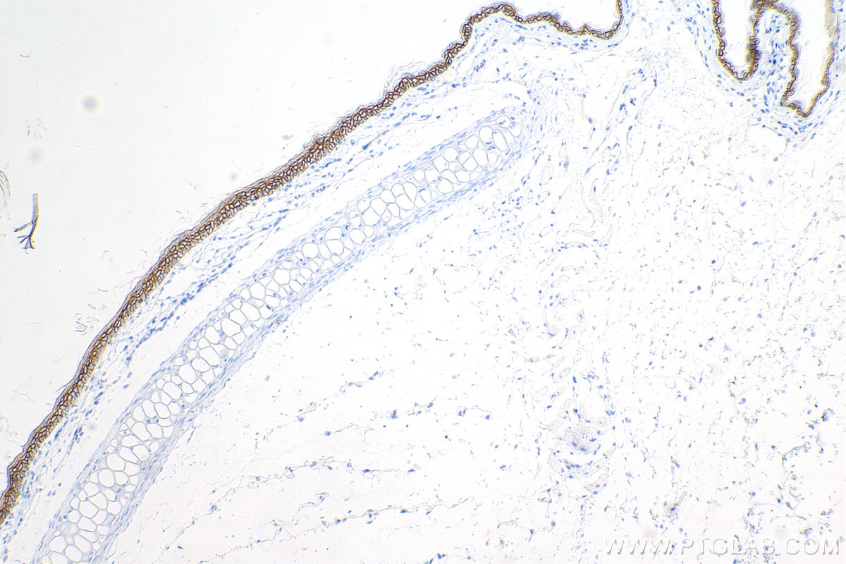 Immunohistochemistry (IHC) staining of mouse skin tissue using E-cadherin Recombinant antibody (84111-1-RR)