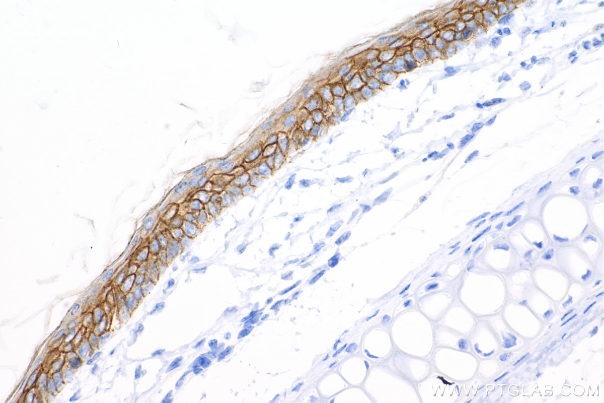 Immunohistochemistry (IHC) staining of mouse skin tissue using E-cadherin Recombinant antibody (84111-1-RR)