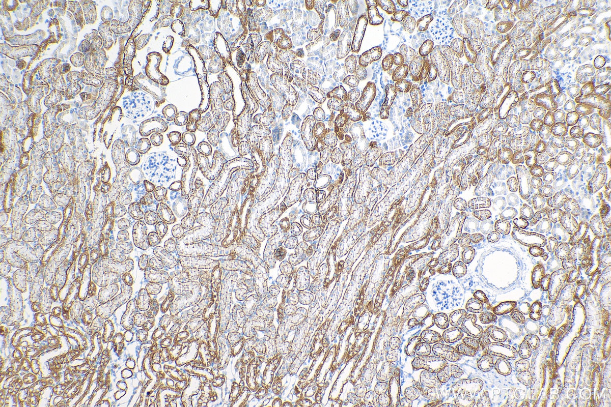 Immunohistochemistry (IHC) staining of mouse kidney tissue using E-cadherin Recombinant antibody (84111-1-RR)