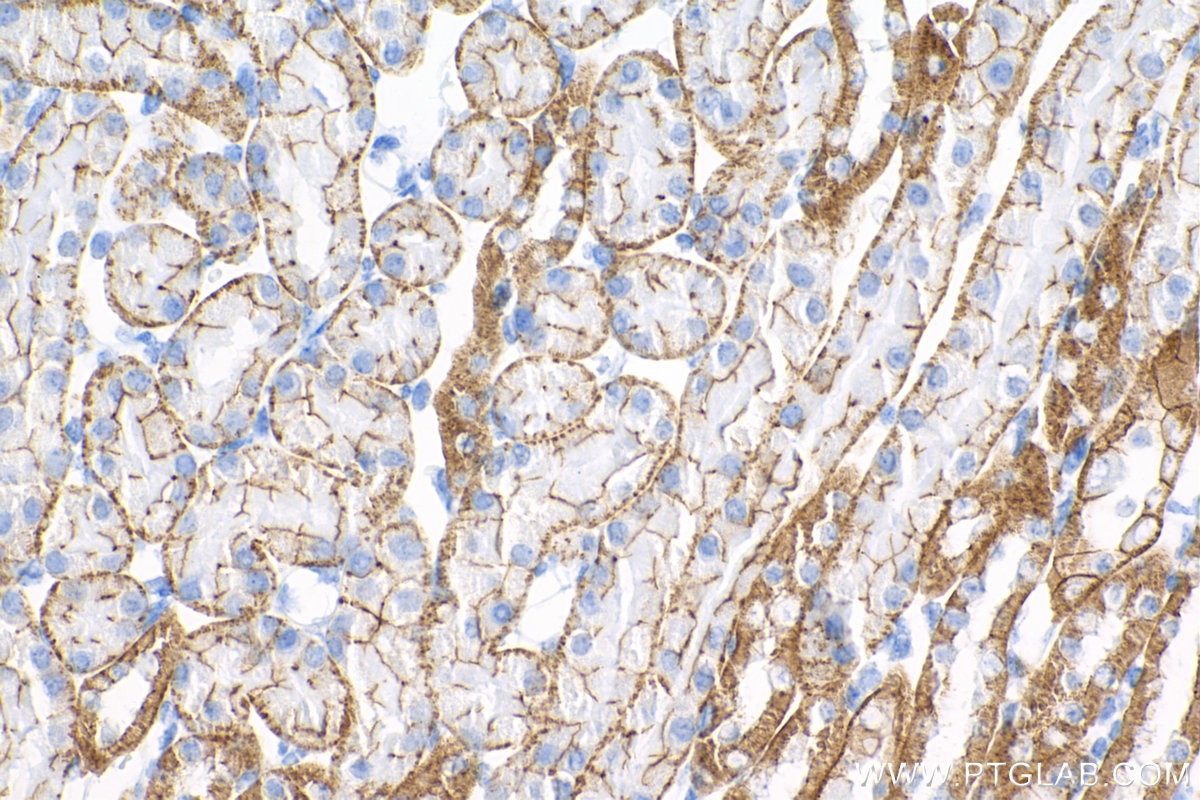 Immunohistochemistry (IHC) staining of mouse kidney tissue using E-cadherin Recombinant antibody (84111-1-RR)
