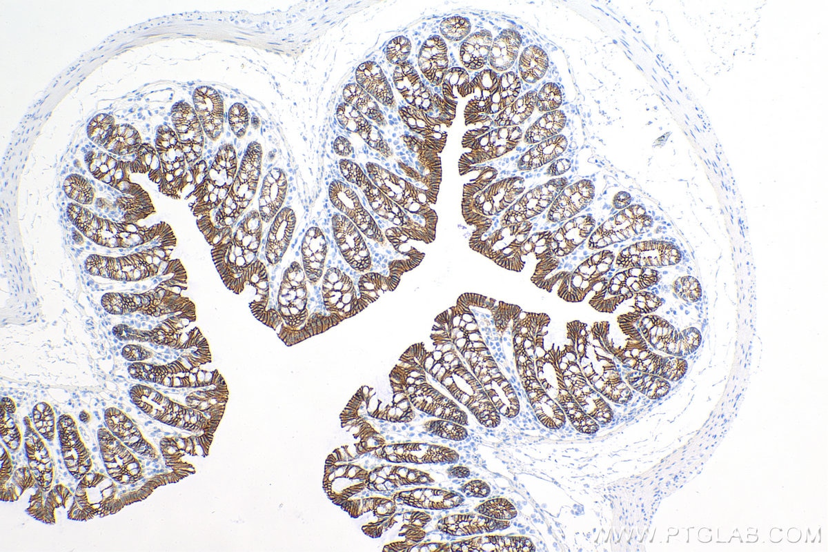 Immunohistochemistry (IHC) staining of mouse colon tissue using E-cadherin Recombinant antibody (84111-1-RR)