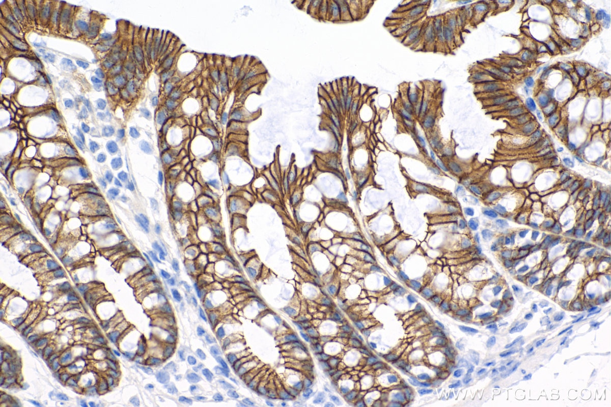 Immunohistochemistry (IHC) staining of mouse colon tissue using E-cadherin Recombinant antibody (84111-1-RR)