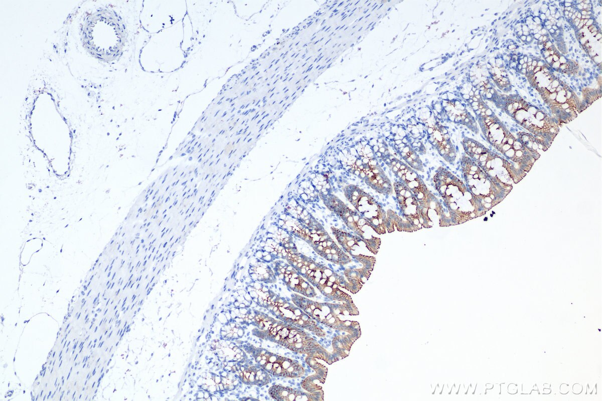 Immunohistochemistry (IHC) staining of rat colon tissue using E-cadherin Recombinant monoclonal antibody (84111-1-RR)