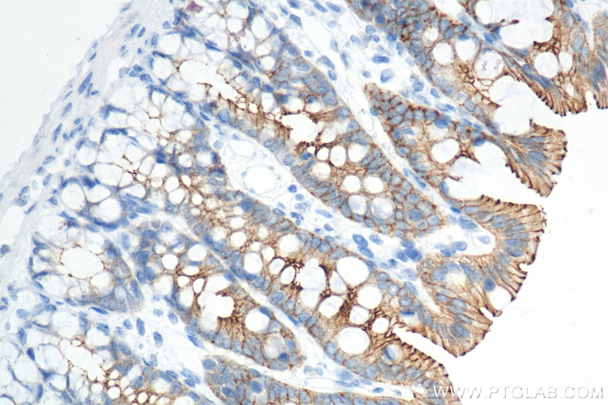 Immunohistochemistry (IHC) staining of rat colon tissue using E-cadherin Recombinant monoclonal antibody (84111-1-RR)