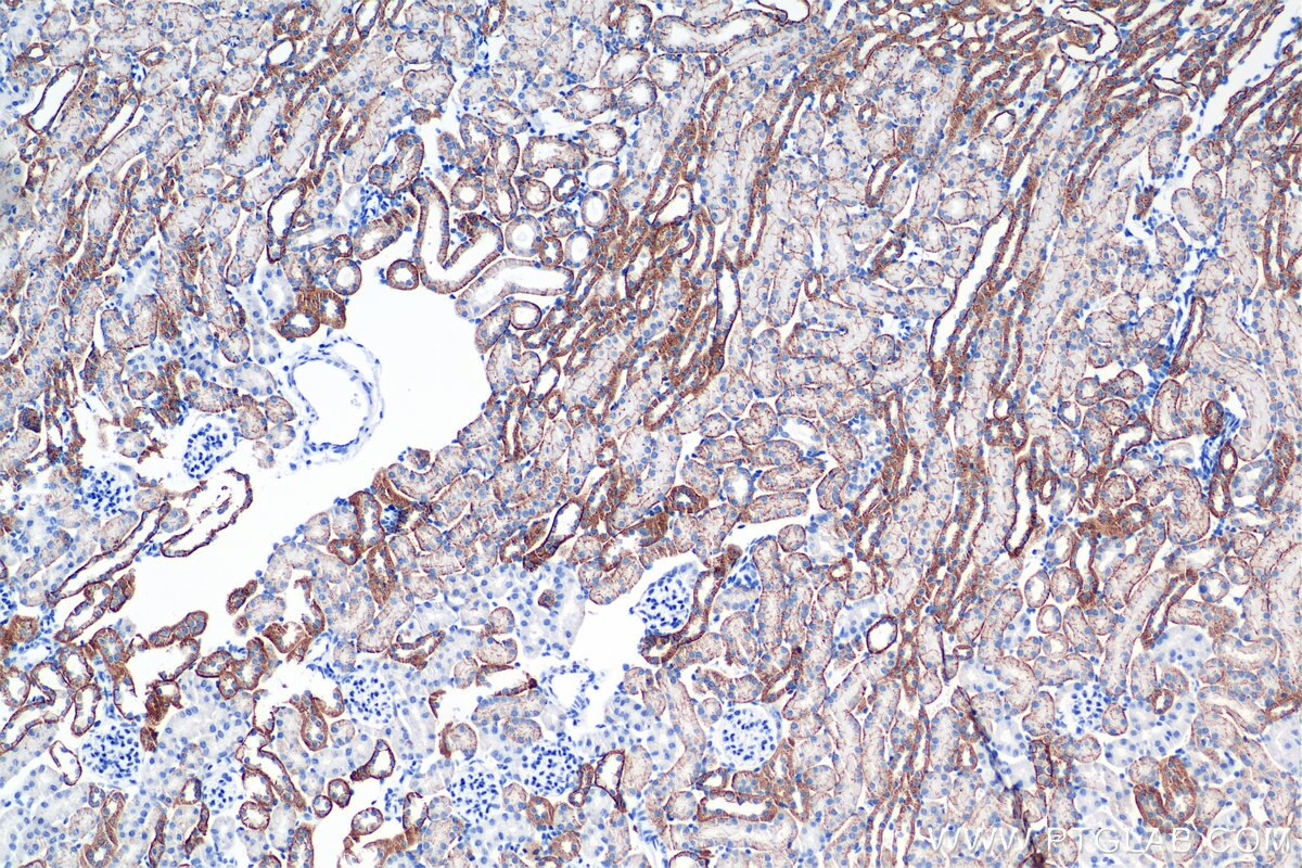 Immunohistochemistry (IHC) staining of mouse kidney tissue using E-cadherin Recombinant monoclonal antibody (84111-1-RR)