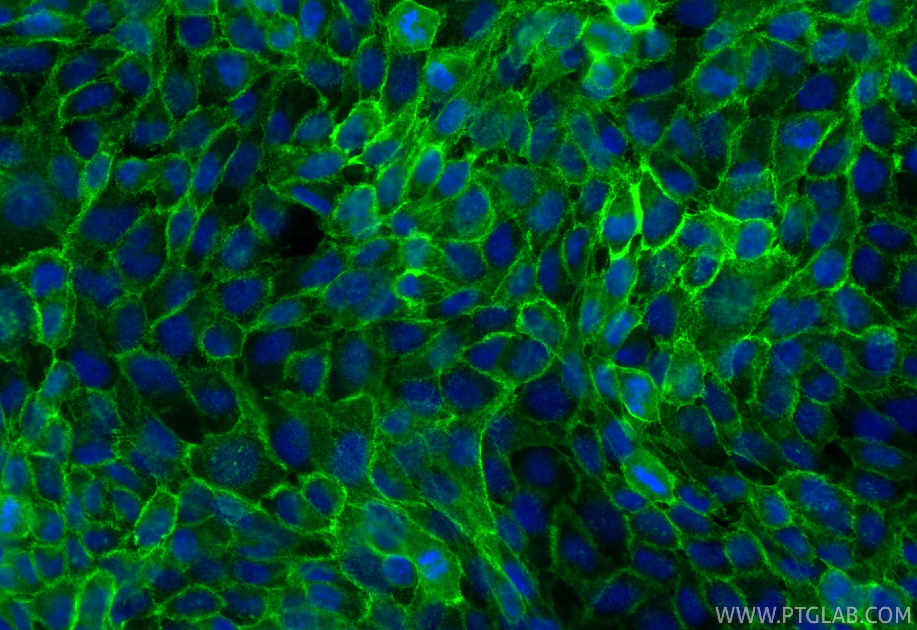 Immunofluorescent analysis of (4% PFA) fixed A431 cells using E-cadherin antibody (84111-2-RR, Clone: 241282A8 ) at dilution of 1:500 and CoraLite®488-Conjugated Goat Anti-Rabbit IgG(H+L) (SA00013-2). This data was developed using the same antibody clone with 84111-2-PBS in a different storage buffer formulation. Immunofluorescence (IF) / fluorescent staining of A431 cells using E-cadherin Recombinant monoclonal antibody (84111-2-RR)