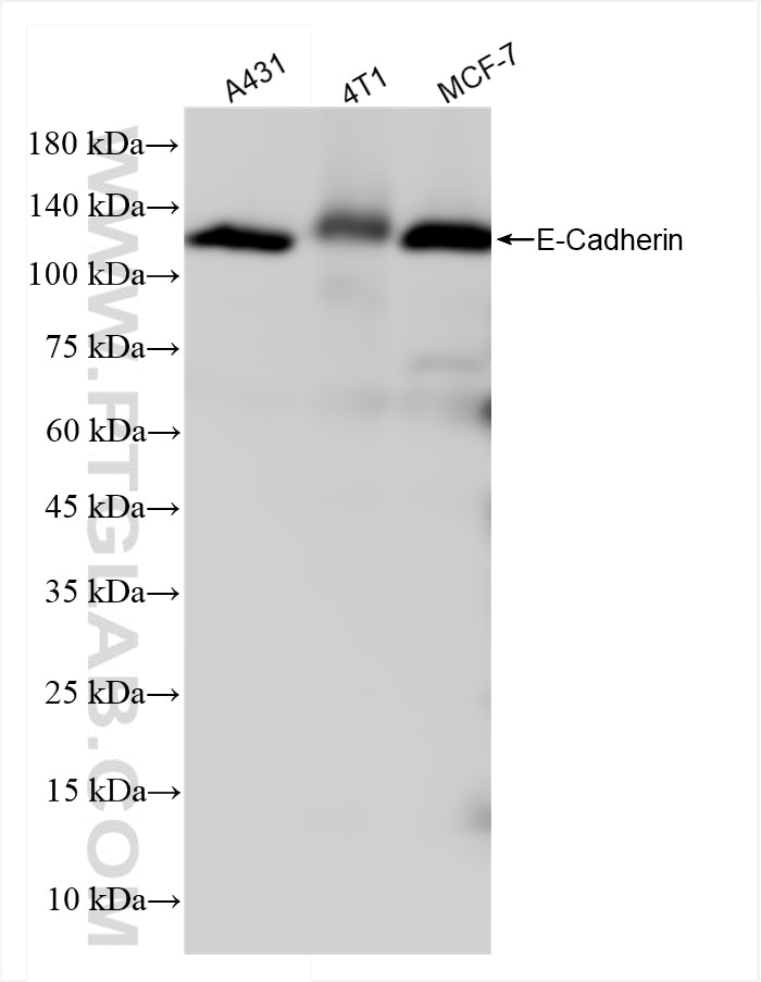 Western Blot (WB) analysis of various lysates using E-Cadherin Recombinant antibody (84111-2-RR)