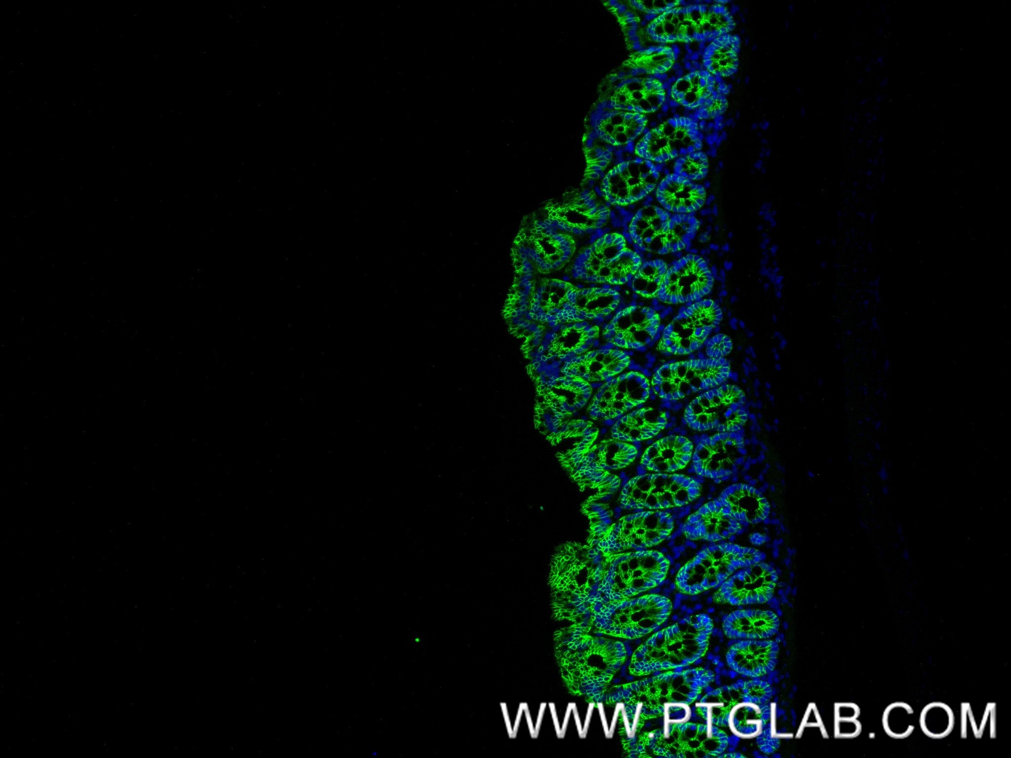 Immunofluorescence (IF) / fluorescent staining of rat colon tissue using E-Cadherin Recombinant antibody (84646-3-RR)
