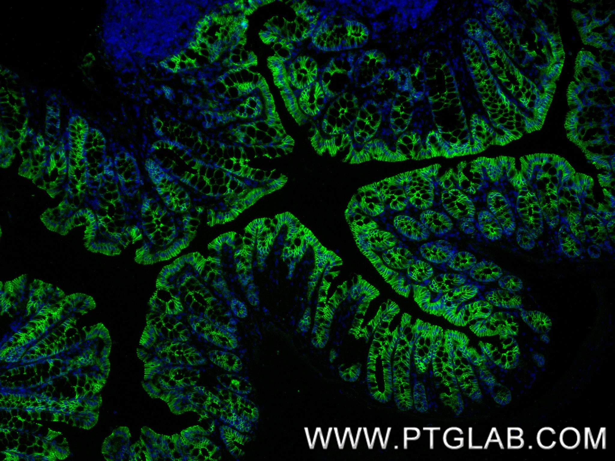 Immunofluorescence (IF) / fluorescent staining of mouse colon tissue using E-Cadherin Recombinant antibody (84646-3-RR)