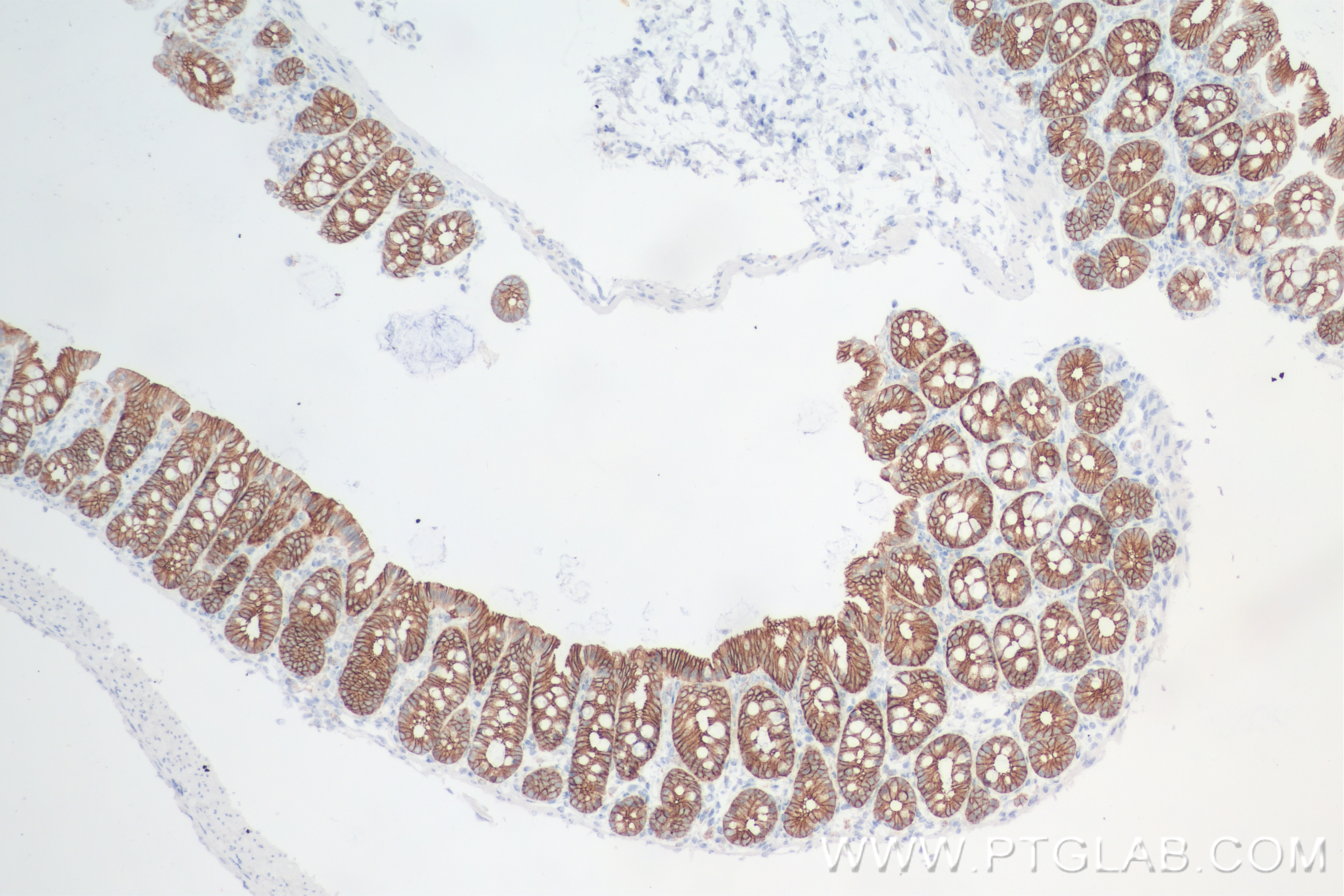 Immunohistochemistry (IHC) staining of rat colon tissue using E-Cadherin Recombinant antibody (84646-3-RR)