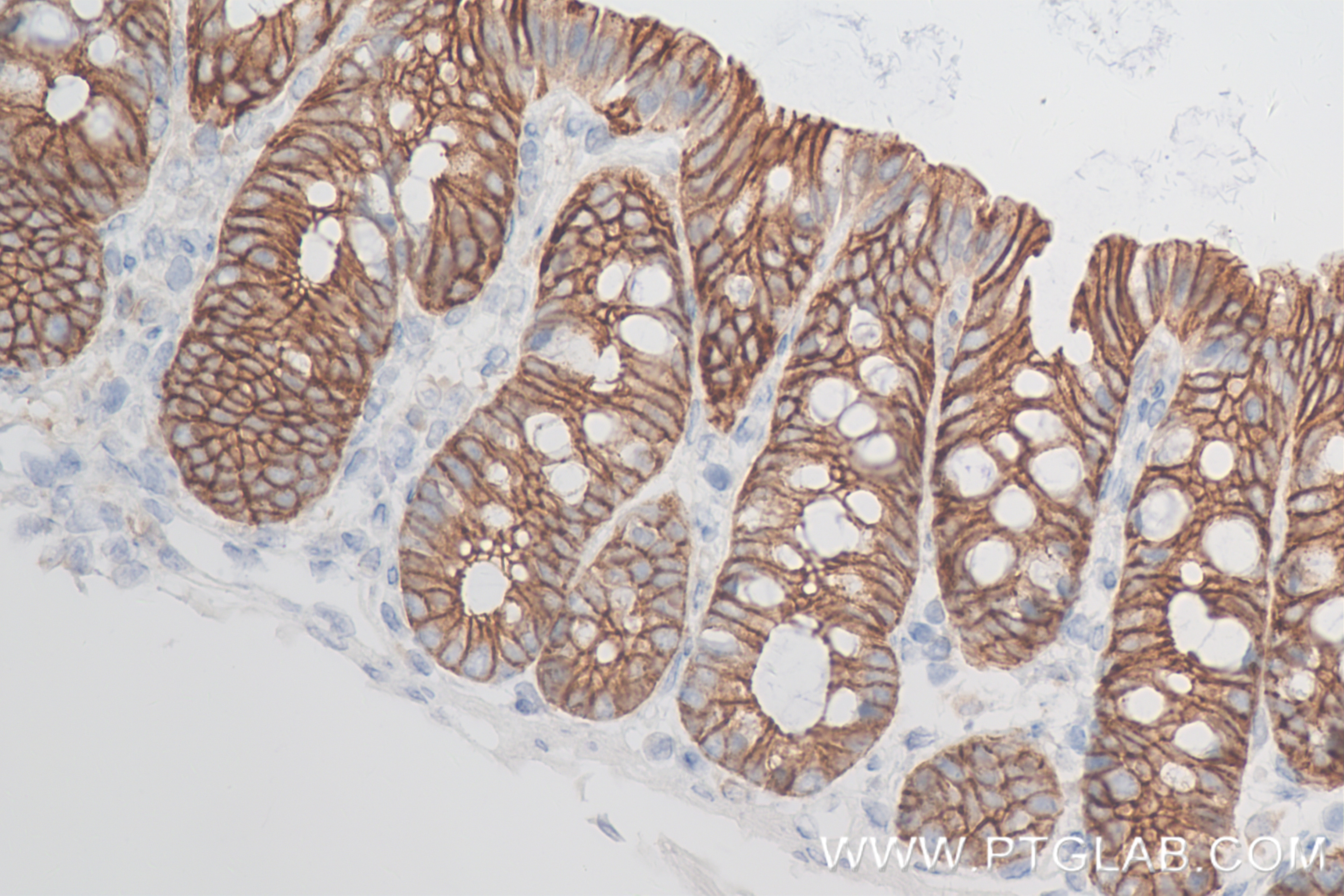 Immunohistochemistry (IHC) staining of rat colon tissue using E-Cadherin Recombinant antibody (84646-3-RR)