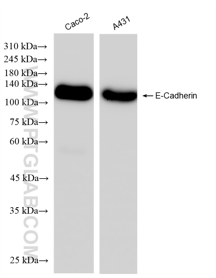 Western Blot (WB) analysis of various lysates using E-Cadherin Recombinant antibody (84646-3-RR)