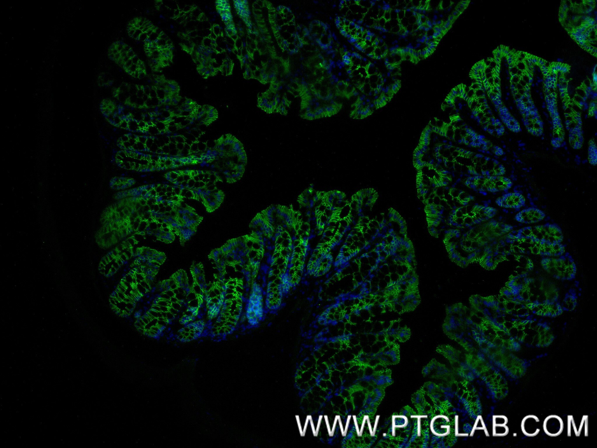 Immunofluorescence (IF) / fluorescent staining of mouse colon tissue using E-Cadherin Recombinant antibody (84646-4-RR)