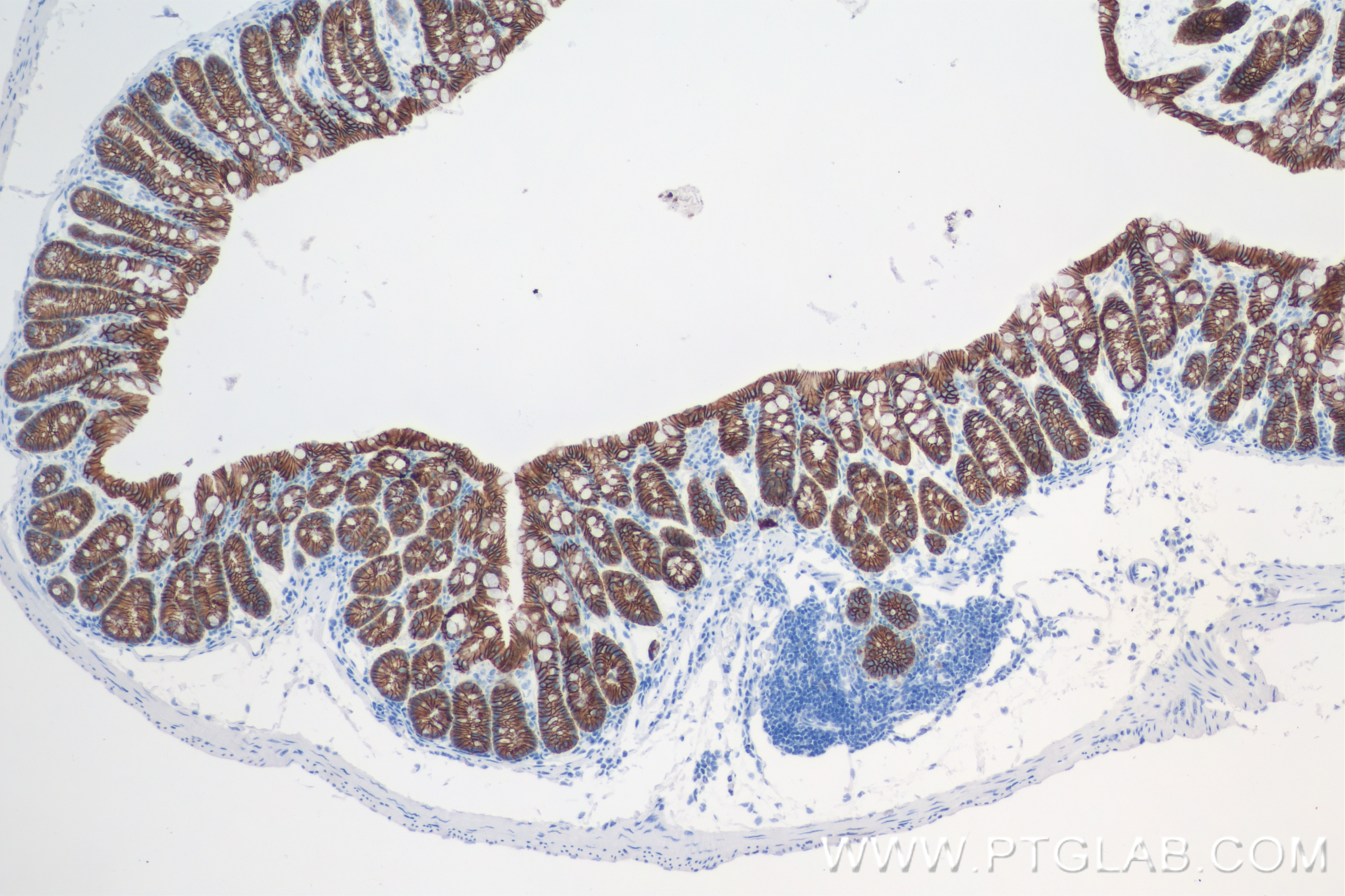 Immunohistochemistry (IHC) staining of mouse colon tissue using E-Cadherin Recombinant antibody (84646-4-RR)