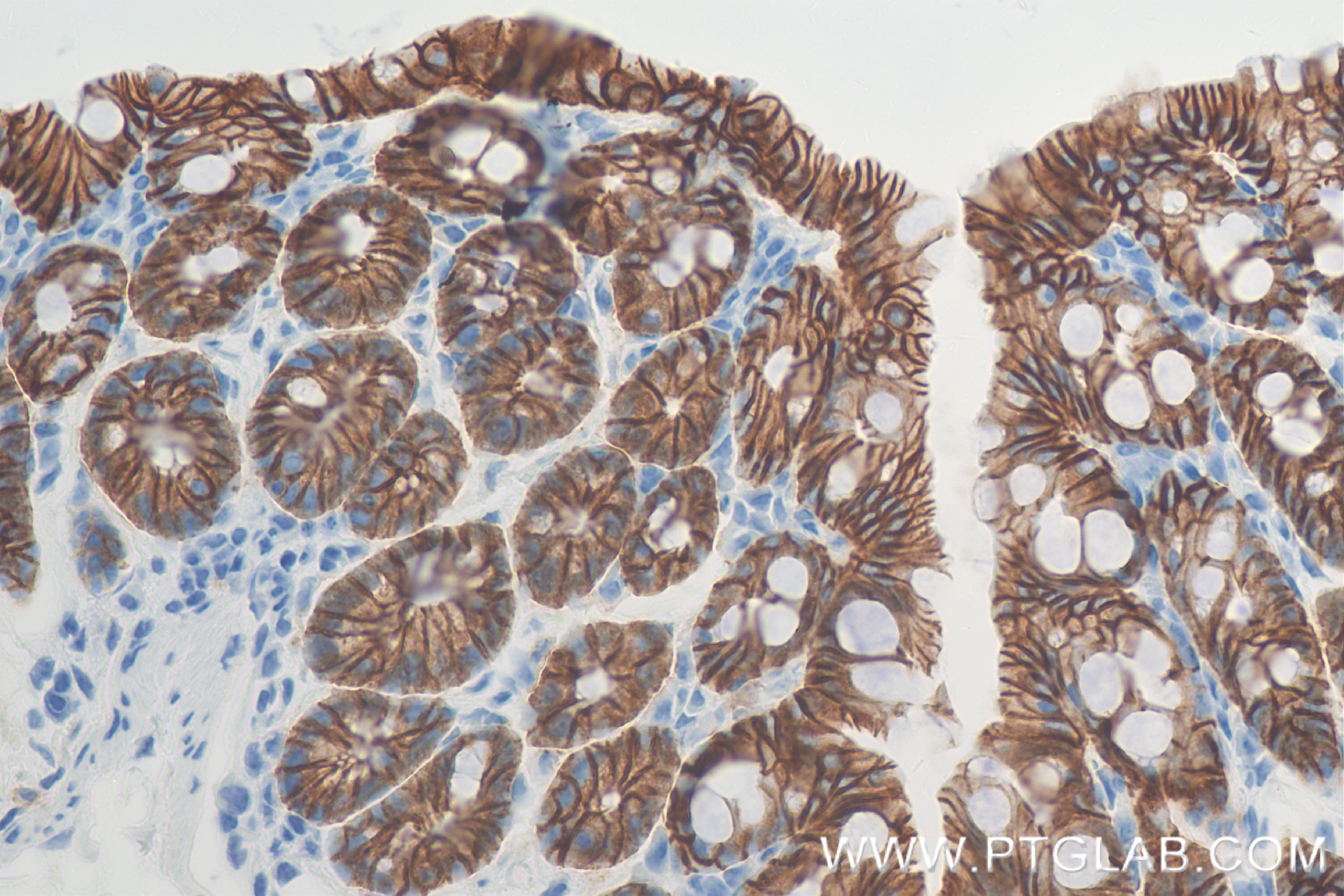 Immunohistochemistry (IHC) staining of mouse colon tissue using E-Cadherin Recombinant antibody (84646-4-RR)