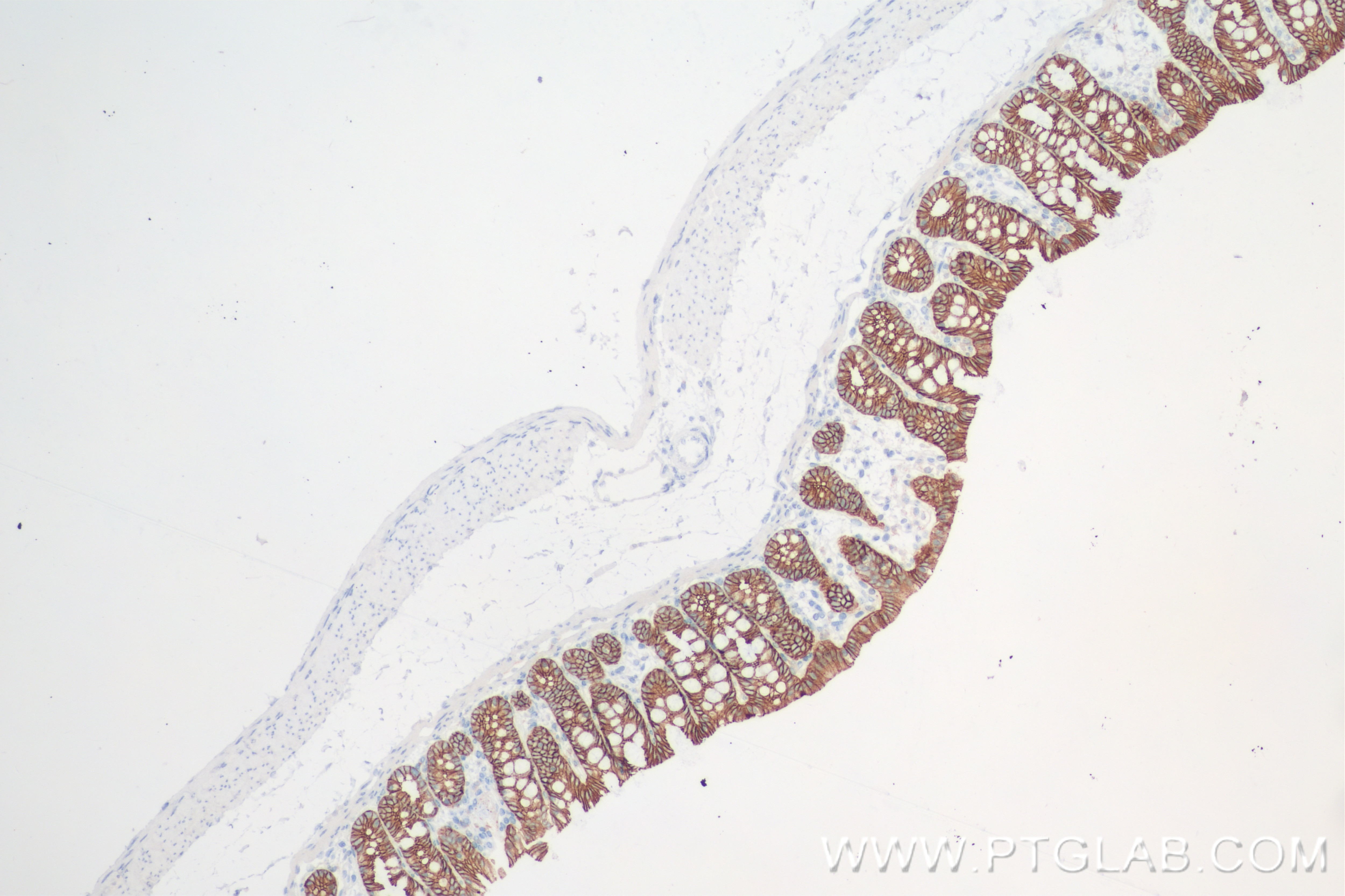 Immunohistochemistry (IHC) staining of rat colon tissue using E-Cadherin Recombinant antibody (84646-4-RR)