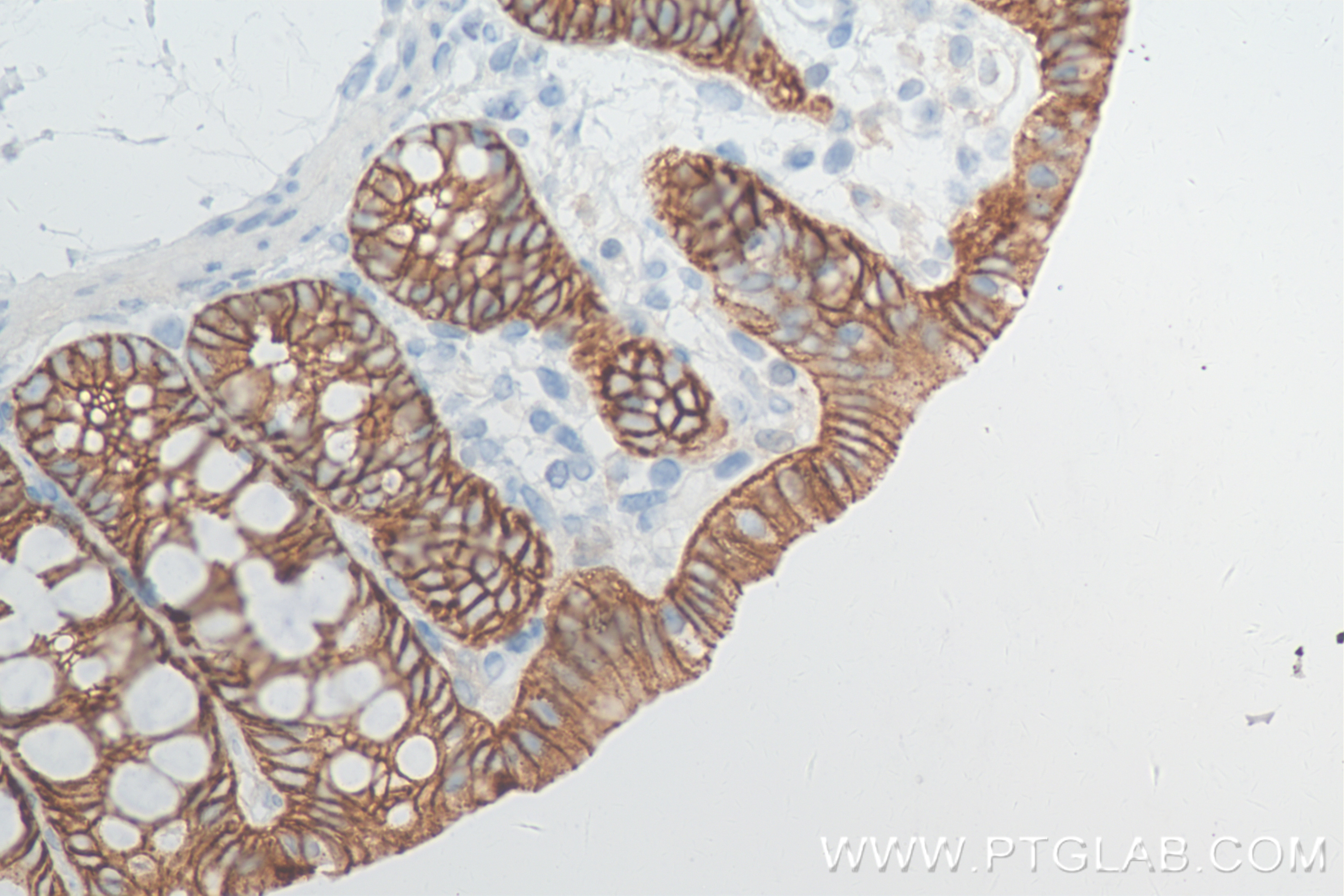 Immunohistochemistry (IHC) staining of rat colon tissue using E-Cadherin Recombinant antibody (84646-4-RR)