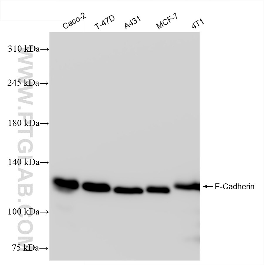 Western Blot (WB) analysis of various lysates using E-Cadherin Recombinant antibody (84646-4-RR)