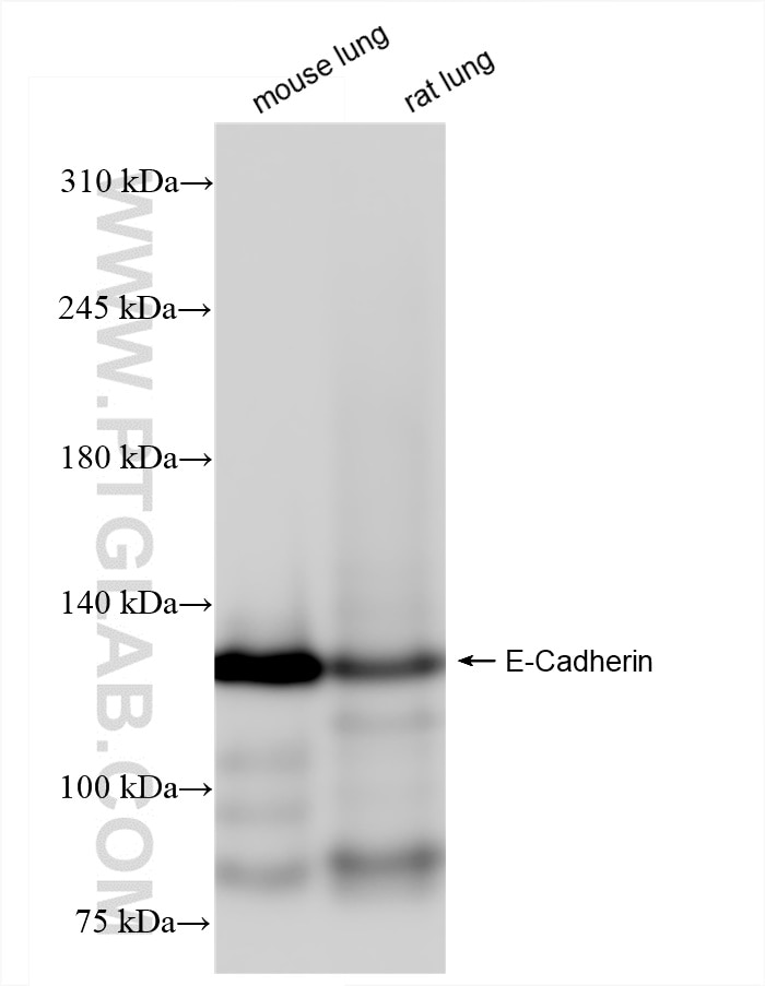 Western Blot (WB) analysis of various lysates using E-Cadherin Recombinant antibody (84646-4-RR)