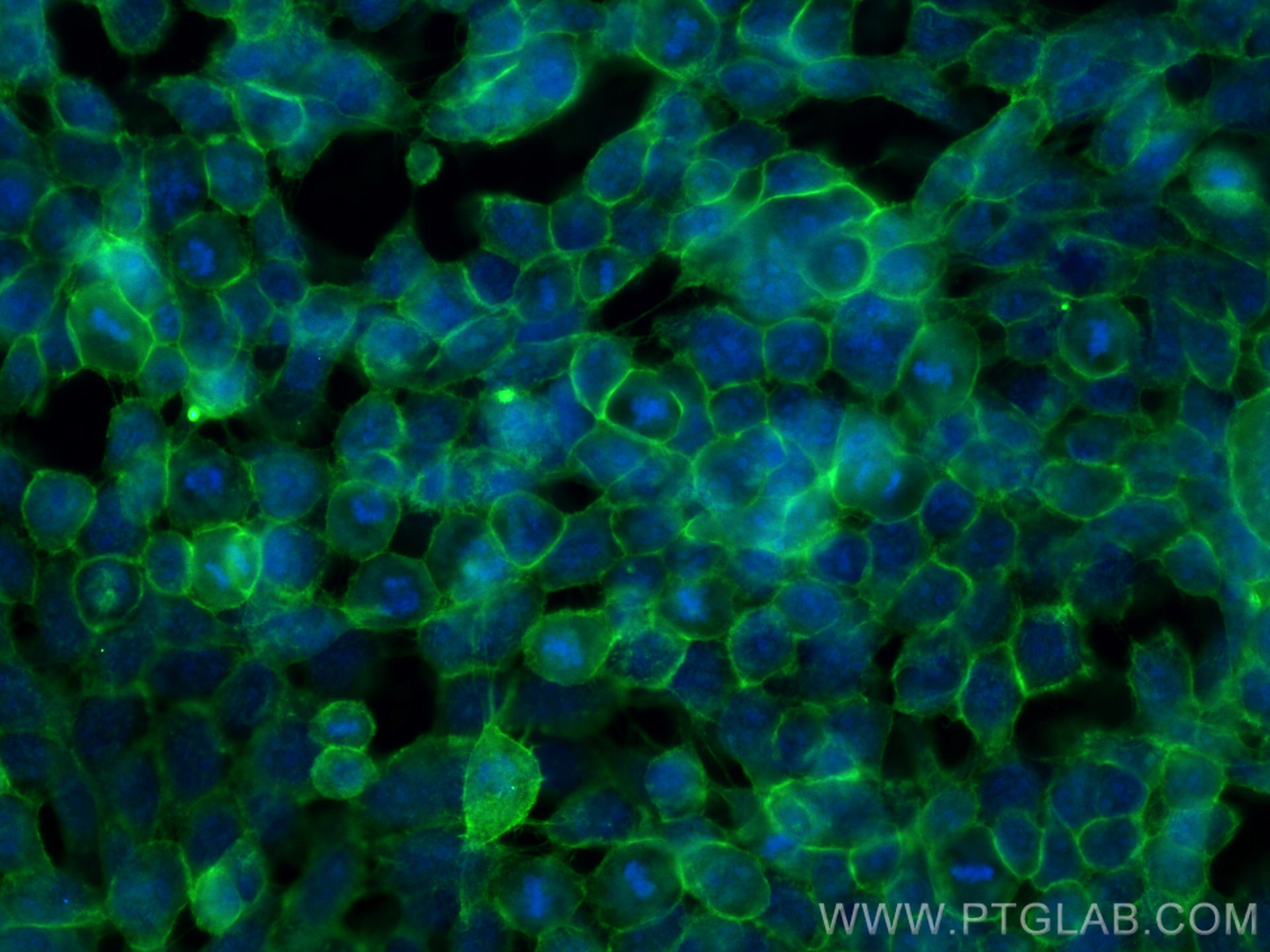 Immunofluorescence (IF) / fluorescent staining of A431 cells using E-cadherin Polyclonal antibody (20874-1-AP)