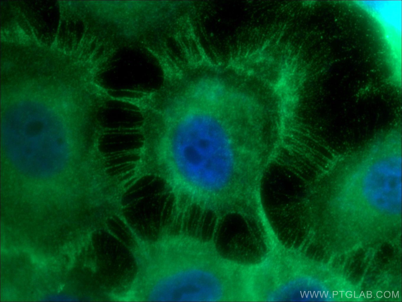 Immunofluorescence (IF) / fluorescent staining of A431 cells using E-cadherin Polyclonal antibody (20874-1-AP)