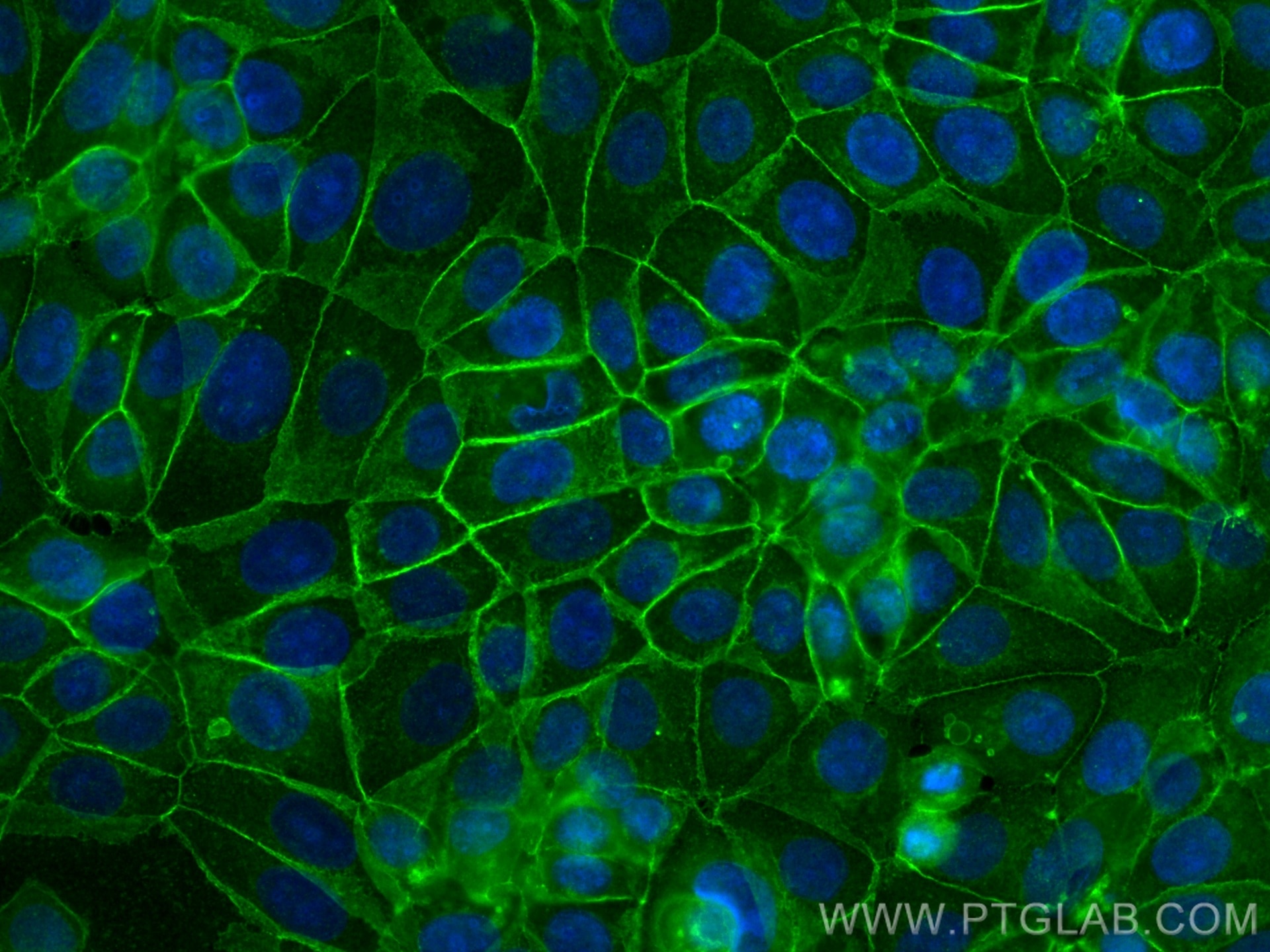 Immunofluorescence (IF) / fluorescent staining of MCF-7 cells using E-cadherin Polyclonal antibody (20874-1-AP)