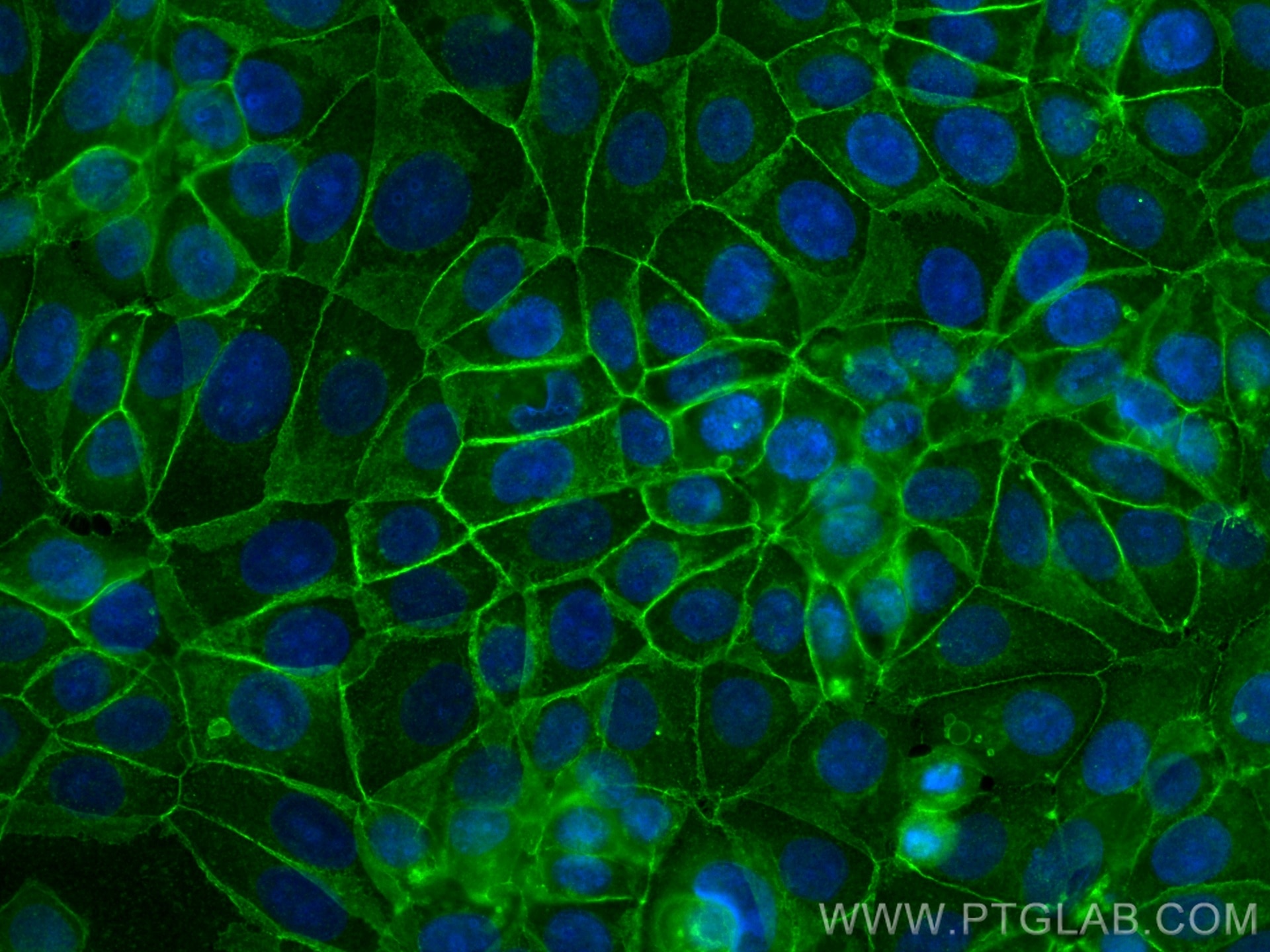 IF Staining of MCF-7 using 20874-1-AP